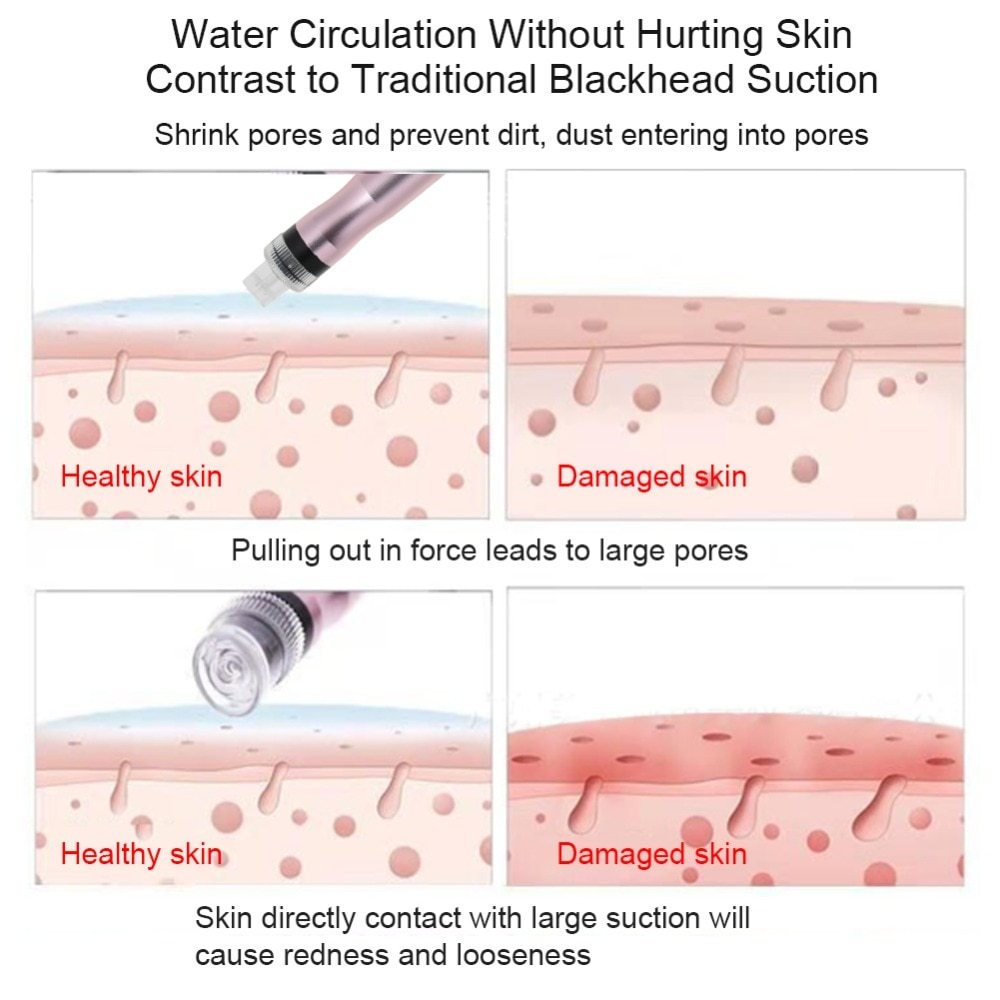Portable Oxygen Spray & Hydro Jet Machine – Skin Rejuvenation & Blackhead Removal